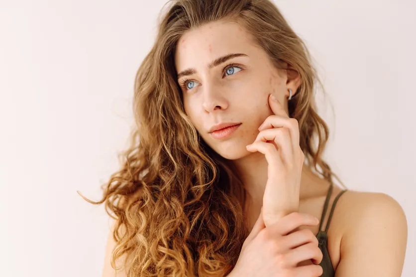 kosmetik rosacea make up