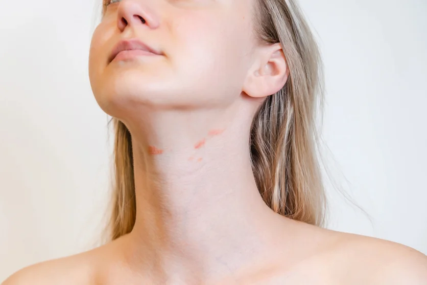 Rote Flecken auf der Haut