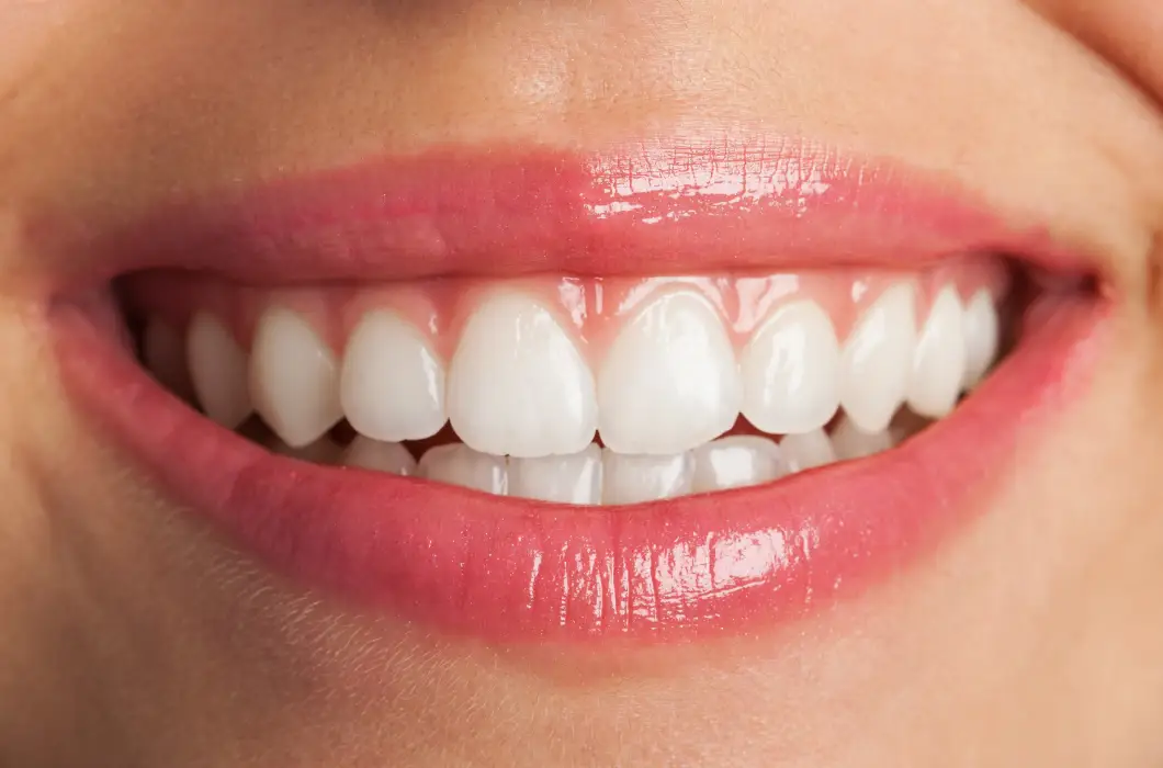 Co zrobić, żeby mieć białe zęby, czyli jak wybielić zęby w domu