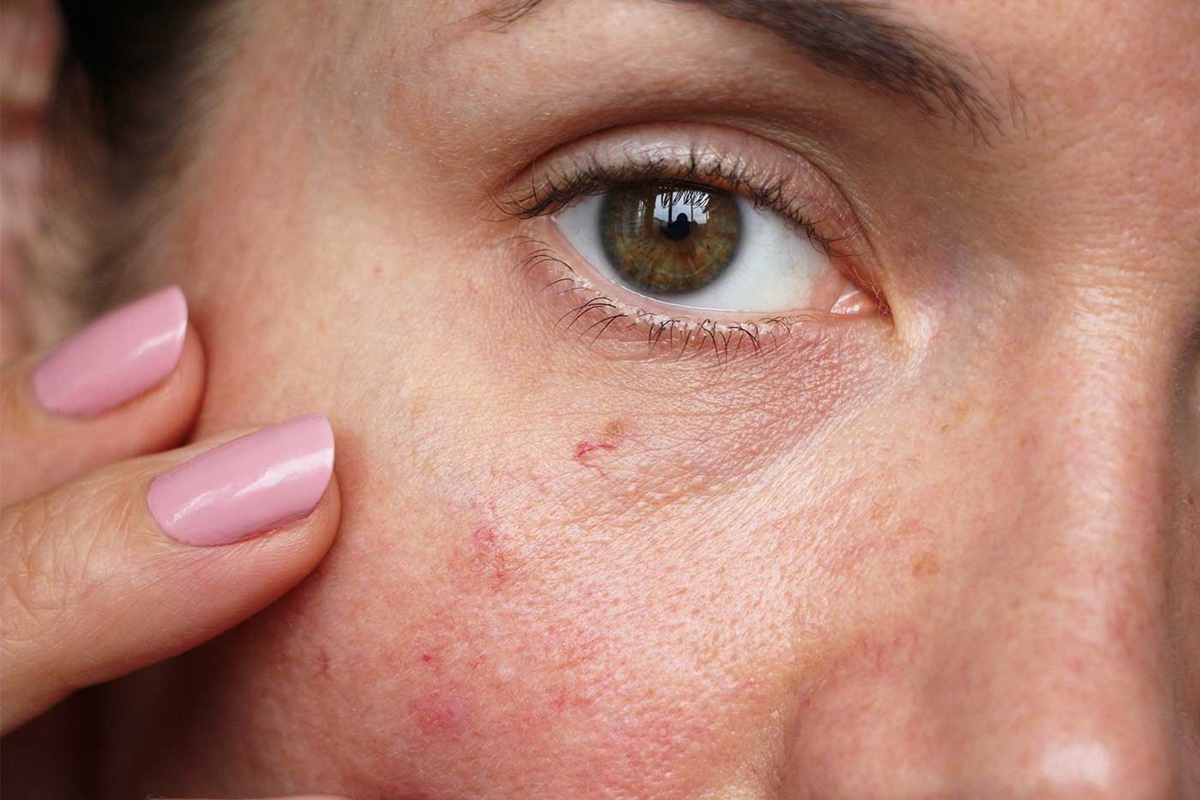 Ranking kosmetyków do zaczerwienionej skóry